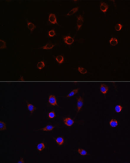 APLP2 Rabbit Polyclonal Antibody (CAB5455)