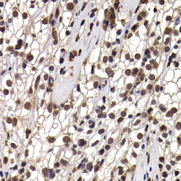 Anti-DDX21 Antibody (CAB7034)