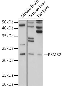 PSMB2 Rabbit Polyclonal Antibody (CAB5483)