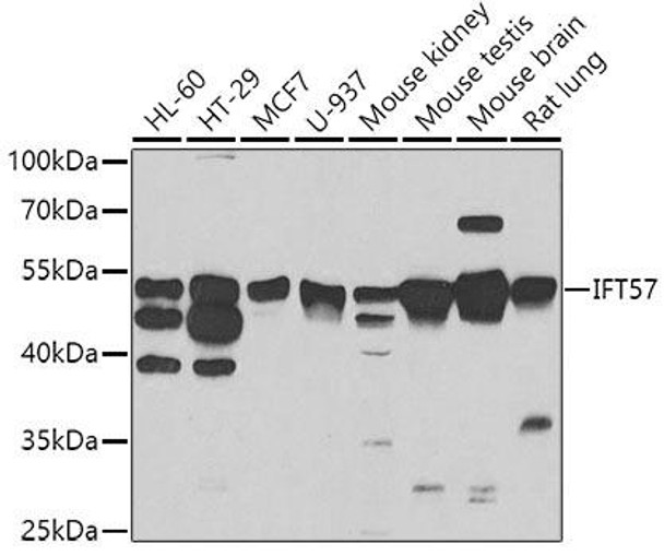 Anti-IFT57 Antibody (CAB7191)