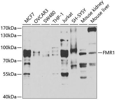 FMRP Rabbit Polyclonal Antibody (CAB5645)
