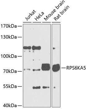 RPS6KA5 Rabbit Polyclonal Antibody (CAB5699)