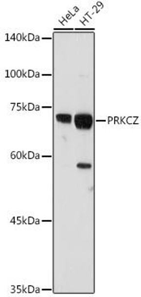 PKC zeta Rabbit Polyclonal Antibody (CAB5714)