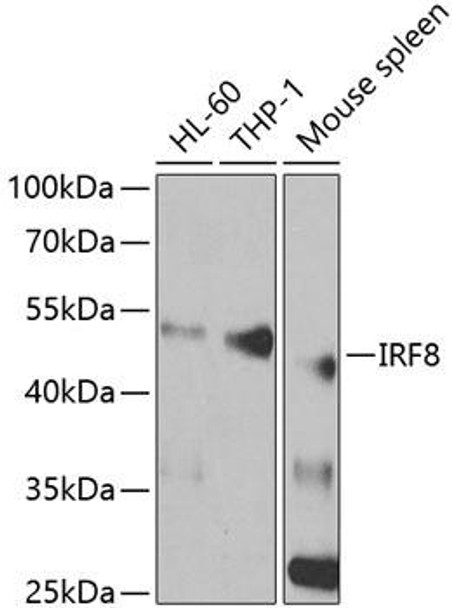 IRF8 Rabbit Polyclonal Antibody (CAB5798)