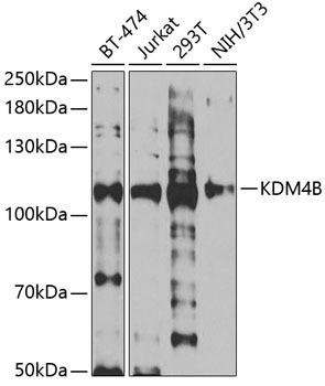 KDM4B/JMJD2B Rabbit Polyclonal Antibody (CAB5824)