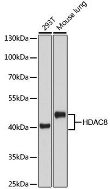 [KO Validated] HDAC8 Rabbit Polyclonal Antibody (CAB5829)
