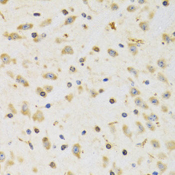 RPS12 Rabbit Polyclonal Antibody (CAB5890)