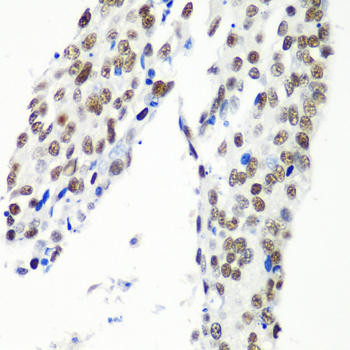 HTATSF1 Rabbit Polyclonal Antibody (CAB5977)