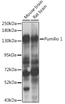 Pumilio 1 Rabbit Polyclonal Antibody (CAB6108)