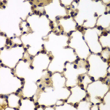 E2F6 Polyclonal Antibody (CAB6151)