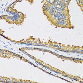 CXCL11 Rabbit Polyclonal Antibody (CAB6201)