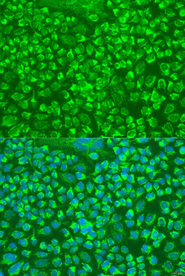 GZMA Rabbit Polyclonal Antibody (CAB6231)