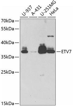 ETV7 Rabbit Polyclonal Antibody (CAB6255)