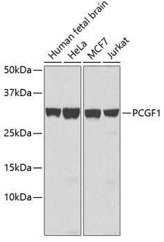 PCGF1 Rabbit Polyclonal Antibody (CAB6338)