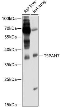 TSPAN7 Rabbit Polyclonal Antibody (CAB6417)