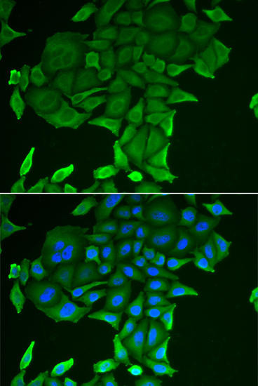 CD84 Rabbit Polyclonal Antibody (CAB6433)