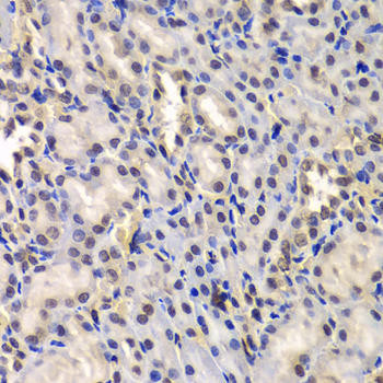 DDX41 Rabbit Polyclonal Antibody (CAB6576)