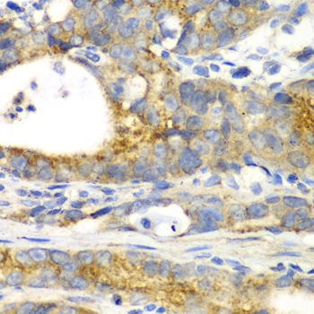 GRASP65 Rabbit Polyclonal Antibody (CAB6609)