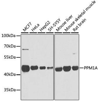 PPM1A Rabbit Polyclonal Antibody (CAB6699)