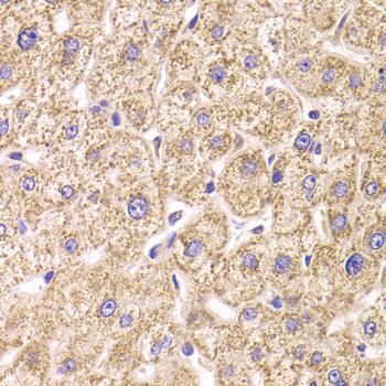 ST3GAL3 Rabbit Polyclonal Antibody (CAB6753)