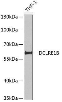 DCLRE1B Rabbit Polyclonal Antibody (CAB6808)