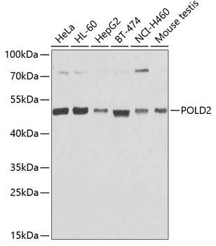 POLD2 Rabbit Polyclonal Antibody (CAB6834)