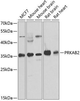 PRKAB2 Rabbit Polyclonal Antibody (CAB6952)