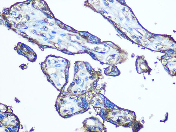 GLUT1/SLC2A1 Rabbit Polyclonal Antibody (CAB6982)