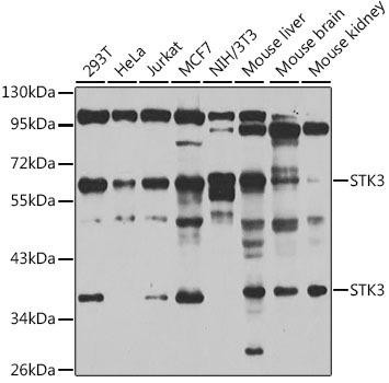 STK3/MST2 Rabbit Polyclonal Antibody (CAB6992)