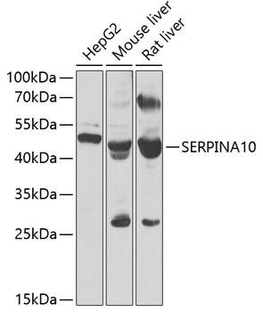 SERPINA10 Rabbit Polyclonal Antibody (CAB7106)