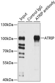 ATRIP Rabbit Polyclonal Antibody (CAB7139)
