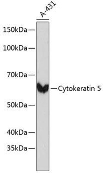 Anti-Cytokeratin 5 Antibody (CAB11396)