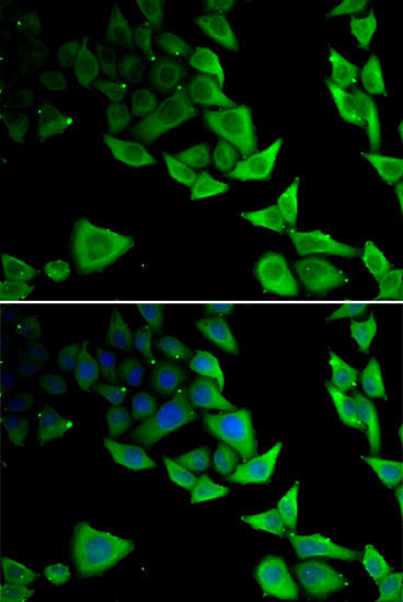 α-Synuclein Rabbit Polyclonal Antibody (CAB7215)