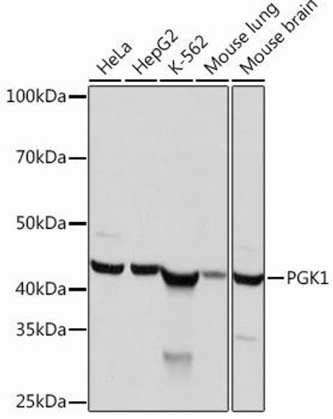 Anti-PGK1 Antibody (CAB12686)