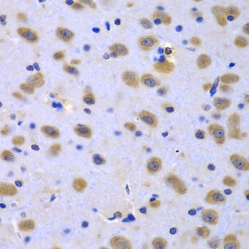 CIAO1 Rabbit Polyclonal Antibody (CAB7355)
