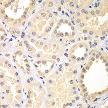 SPIN2B Rabbit Polyclonal Antibody (CAB7407)