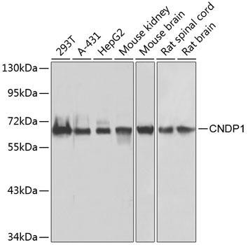 CNDP1 Rabbit Polyclonal Antibody (CAB7485)
