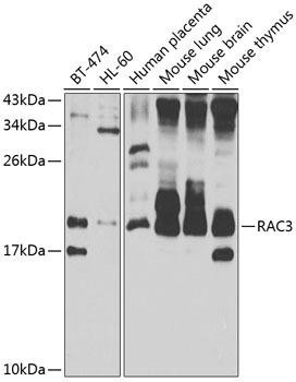RAC3 Rabbit Polyclonal Antibody (CAB7498)