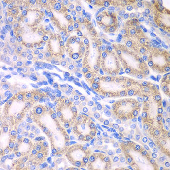 ALDH1A2 Rabbit Polyclonal Antibody (CAB7503)