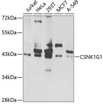 CSNK1G1 Rabbit Polyclonal Antibody (CAB7510)