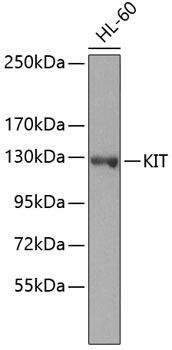 KIT Rabbit Polyclonal Antibody (CAB7521)