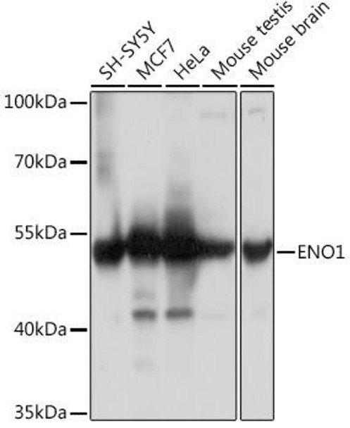 Anti-ENO1 Antibody (CAB16842)