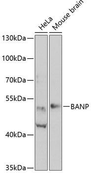 BANP Rabbit Polyclonal Antibody (CAB7595)