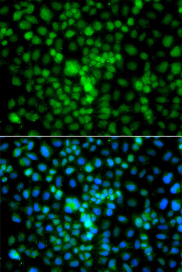 CIDEA Rabbit Polyclonal Antibody (CAB7655)