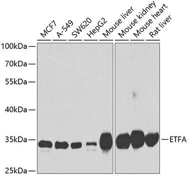 ETFA Rabbit Polyclonal Antibody (CAB7670)