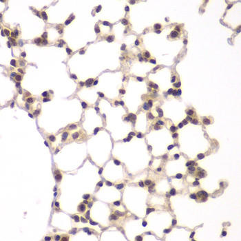 VRK1 Rabbit Polyclonal Antibody (CAB7745)