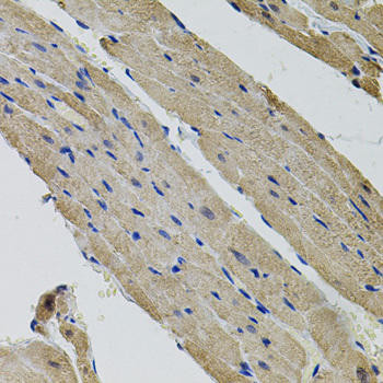ALDH9A1 Rabbit Polyclonal Antibody (CAB7875)