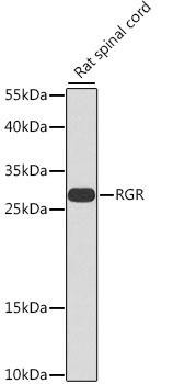 RGR Rabbit Polyclonal Antibody (CAB7925)