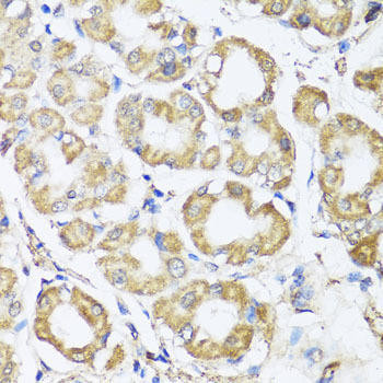 B9D1 Rabbit Polyclonal Antibody (CAB7973)