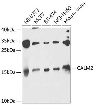 CALM2 Rabbit Polyclonal Antibody (CAB8008)